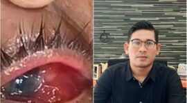 Warga Aceh Besar Diduga Alami Kebutaan Usai Diberi Obat ‘Ekspired’ : YARA minta Polisi usut