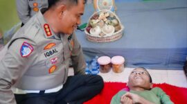 Penderita Lumpuh layu ini tercapai keinginannya Bertemu dengan Dirlantas Aceh