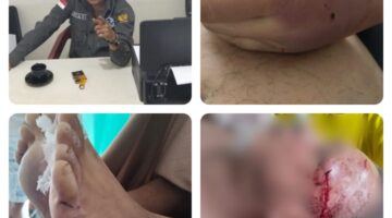 Wartawan Online Medan, Nico Saragih, Ditemukan Tewas di Kos: Diduga Korban Kekerasan, Polisi Lakukan Penyelidikan